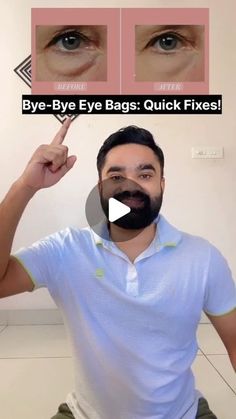 Makeup Eye Bags, Gua Sha For Eye Bags, Get Rid Of Under Eye Bags, How To Remove Eye Bags, Remedies For Eye Bags, Baggy Eyes Remedy, Eye Bags Remedy, Face Excercise, Get Rid Of Eye Bags