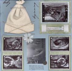 an image of a baby's diaper and its birth pictures are shown in this poster