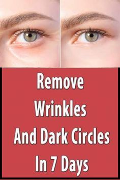 Dark Spot Removal Hacks You Wish You Knew Sooner >>CHECK THIS OUT<< Natural Anti Aging, Deep Skin, Deep Wrinkles