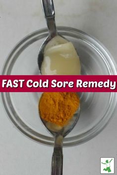 Cold sores or fever blisters, most people get them. There are some wonderful natural remedies to help with the cold sores. Come find out about three fast cold sore remedies that you could be using today! #coldsores #coldsoreremedies #coldsoreremedy #feverblisters #feverblisterremedy #feverblisterremedies #naturalremedies #mrsjonescreationstation Cold Sore Remedy Fast, Heal Cold Sores Fast, Cold Remedy Tea, Fever Blister Remedy, Cold Sore Remedies, Baby Cold Remedies, How To Heal Blisters, Home Remedies For Cold, Home Remedies For Fever