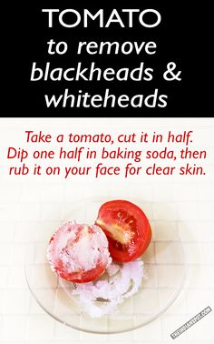 Wrinkle Skin Care, Blackhead Remedies, Blackheads And Whiteheads, Anti Wrinkle Skin Care, Rid Of Blackheads, Blackheads Removal, Homemade Lip Balm, Remove Blackheads, Skin Care Wrinkles