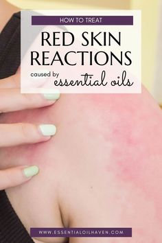 Got redness or itching from essential oils? Add fatty oils like almond or jojoba oil to the affected area. No carrier oils? No worries! Kitchen oils like olive or sunflower can help. Read on for immediate relief steps! Summer Diffuser Blends, Diy Hair Oil, Essential Oil Books, Best Diffuser, Essential Oil Extraction, What Are Essential Oils