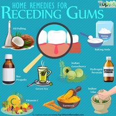 Top 10 Home Remedies, Gum Recession, Gum Care, Receding Gums, Oil Pulling, Gum Health, Cold Home Remedies, Sleep Schedule