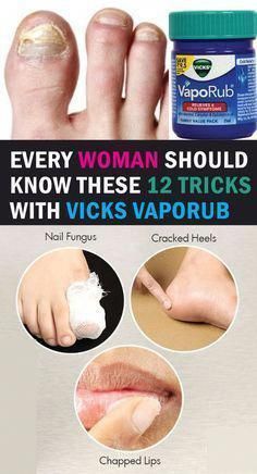 Vic Vaporub, Natural Antifungal, Vicks Vapor Rub, Vicks Vapor, Vicks Vaporub Uses, Uses For Vicks, Nail Fungus Remedy, Vapor Rub