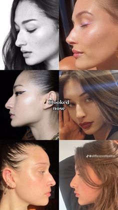 Plastic Surgery Fails, Models With Big Noses, Jaw Reduction Surgery, Bulbous Nose, Plastic Surgery Fail, Face Surgery, Plastic Surgery Gone Wrong