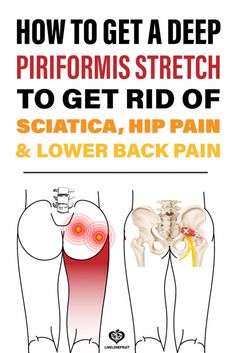 how to get a deep priformis stretch to get rid of sciatica, hip pain and lower back pain