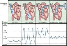 an image of the heart with different stages