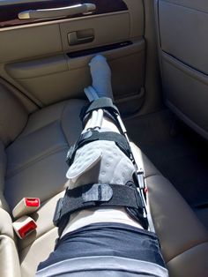 Broke Leg Snapchat, Doing The Right Thing, Leg Injury, Bra Image, Medical Photos