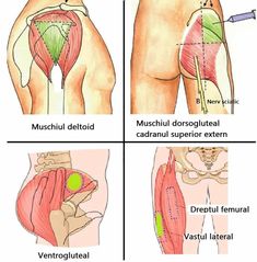 the different muscles are shown in this diagram