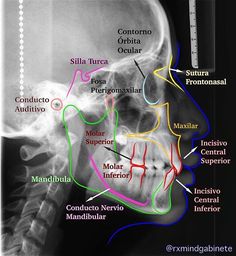 an x - ray image shows the bones and their major structures, including the cranium