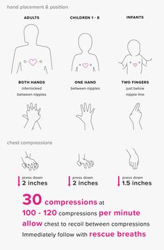 How to Perform CPR: Hands-Only and Mouth-to-Mouth Le Mal A Dit, How To Perform Cpr, First Aid Cpr, Cardiopulmonary Resuscitation, First Aid Tips, Cpr Training, Medical School Studying, Survival Life Hacks