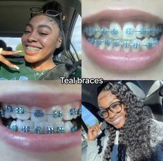 Power Chain Braces, Braces Colours, Dental Braces Colors, Braces Colors Combinations, Braces Cute, Braces Food, Cute Braces Colors, Pretty Teeth, Braces Tips