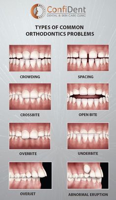 orthodontic Orthodontist Assistant, Dental Assistant Study Guide, Dental Nursing, Dentist Marketing, Hygiene School, Dental Nurse, Dental Advertising