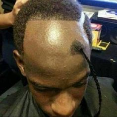 Hairstyles For Bad Hairline, Ugly Hair Cuts, Worst Haircut Ever, What Haircut Should I Get, Bad Hairline, Haircut Fails, Ugly Hair, Hair Fails, Waves Haircut