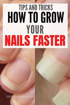 Don't let ragged cuticles or cracked skin detract from your fabulous nail art Grow Your Nails Faster, Healthy Nail Polish, Health Signs