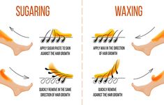 Sugaring Vs Waxing, Natural Facial Hair Removal, Waxing Tips, Homemade Facial Mask, Types Of Wax, Sugar Waxing, Hair Removal Methods, Body Hair Removal, Hair Removal Cream