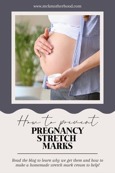 Are you looking to prevent those pregnancy stretch marks but can't find anything worth trying?! On the blog at MCK | Pregnancy & Motherhood, find all the tea on pregnancy stretch marks and a homemade belly butter to help prevent stretch marks! 🥰 But don't forget that stretch marks are not something that make you less beautiful or worthy! Stretch Mark Cream