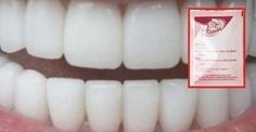 Mit diesem Trick erhältst du weiße Zähne in 180 Sekunden. Und biologisch ist es auch noch! Get Whiter Teeth, Natural Teeth Whitening, Natural Teeth, White Teeth, Pencil Eyeliner, Beauty Treatments, Vaseline, Teeth Whitening