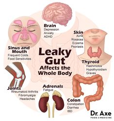 Heal Leaky Gut Naturally, Low Energy Remedies, Autoimmune Disorder, Food Sensitivities