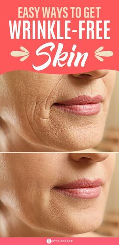 Black Pores On Legs Home Remedies For Wrinkles, Tips For Oily Skin, Wrinkle Free Skin, Glow Skin, Wrinkled Skin, Deep Wrinkles, Youthful Skin, Wrinkle Remover