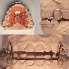 Dental Assistant Study, Dentist Art, Dental Hygiene Student, Dental Aesthetics, Orthodontic Appliances, Dental Anatomy, Dental Technician, Dental Facts