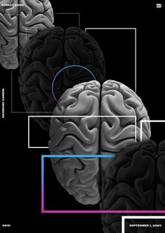 an image of the human brain with different sections