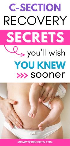 c section recovery, c-section recovery tips, new mom tips, c-section essentials, postpartum hacks, c-section tips Free Pregnancy Stuff, New Mom Advice, Pregnancy Freebies, Postpartum Workouts, Birth Recovery, C Section Scars, Postpartum Essentials, C Section Recovery