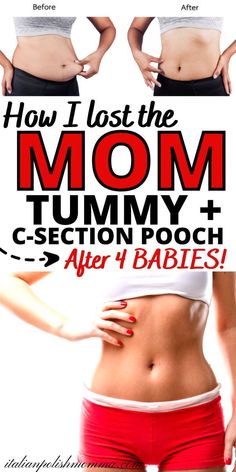 A mom who got rid of her postpartum belly after 4 babies and the best tips to lose the c-section belly pooch. Mom Tummy Workout Belly Pooch, C Section Pooch, Mommy Tummy Workout, Lose Belly Pouch, C Section Belly, Mom Pooch, Mom Tummy, C Section Workout, Post Pregnancy Belly