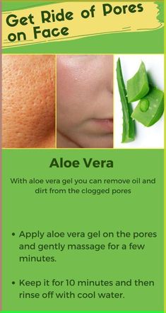 How do you use aloe vera gel for spotless skin? Can aloe vera gel make your skin glow? Can I get clear skin with aloe vera gel? How do you use aloe vera for clear skin and glowing face? Face Open Pores Remedy, Does Aloe Vera Help Acne, How To Apply Aloe Vera To Face, Benefits Of Aloe Vera For Skin, Open Pores On Face How To Get Rid, Aleo Vera For Face, Byuti Tips, Open Pores On Face, Pores On Face