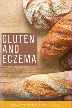 Can gluten trigger eczema? While each person is different, gluten can definitely trigger an eczema flare up. Discover whether a gluten-free diet for eczema works here. Lip Care Tips, Foods To Avoid, Gluten Free Diet, Plant Based Diet, Gluten Free, Diet, 10 Things