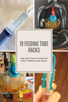 Are you new to tubie life and overwhelmed? Maybe you’re a long-time feeding tube user, but looking for some new ideas? These essential feeding tube hacks will make life with a feeding tube ju… Mickey Button Feeding Tube, Feeding Tube Accessories, Diy Feeding Tube Backpack, Ng Tube Baby Hacks, J Tube Feeding, G Tube Feeding