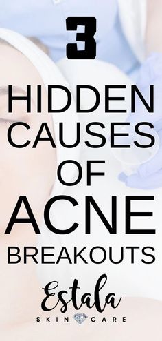 Is Lemon Juice Good For Acne Scars? Lemon and its extracts have been extensively used in various skin care products due to their powerful antioxidant potential. In general, antioxidants can help in... Nodular Acne, Acne Reasons, Causes Of Acne, Stubborn Acne, Acne Prone Skin Care, Bad Acne, Face Care Tips, Natural Acne Remedies