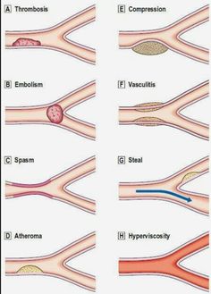 different types of blood vessels in the body