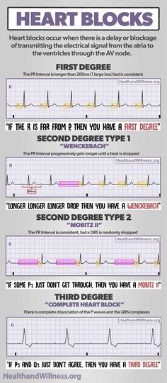 an info sheet describing the different types of blood pressures and how to use them