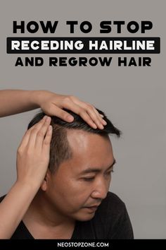 It can be recurred in both men and women but is more common in men. Some studies suggest that age also plays a role in regrowing the hairline, but there is no scientific support. The remaking of the hairline always begins with the temples, moving slowly taking the shape of the "M". Some people may also experience bald at the top of the skull. A Receding Hairline occurs when the hair on the sides of the head falls into the telogen phase, and new hair does not grow back. Regrow Hairline, Men Hairline, Haircuts For Receding Hairline, Hair Tips For Men, Hairstyles For Receding Hairline, Regrow Hair Naturally, Receding Hair Styles, Hair Growth For Men, How To Grow Your Hair Faster