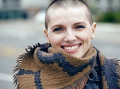 Hair Growth After Chemo, Closeup Portrait, Bald Girl, Lost Hair, Hairstyle Look