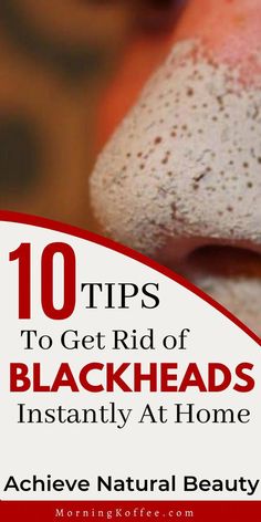 Blackheads On Nose, Rid Of Blackheads, Blackhead Mask, Cold Sores Remedies, How To Get Rid Of Pimples, Natural Sleep Remedies, Natural Cold Remedies, Get Rid Of Blackheads