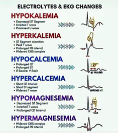 Electrolytes & EKG Changes #medicalschool #resources #medicalstudent - Image Credits: Christine Benedict Paramedic Motivation, Er Medicine, Paramedic Tips, Nursing Theories, Ekg Rhythms