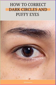 Effective Natural Remedies for Reducing Under-Eye Bags

#NaturalSolutions #UnderEyeCare #ReduceBags #BeautyHacks #HealthySkin Skin And Makeup, Wrinkle Free Skin, Natural Organic Skincare, Modern Muse, Makeup Tricks, Under Eye Bags, Puffy Eyes, Eye Bags, Eye Care