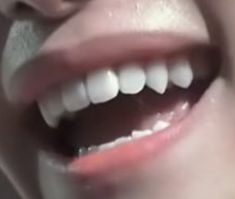 Sharp K9 Teeth Human, K9 Teeth Human, Permanent Vampire Fangs, Pointy Canine Teeth, Sharp Canines Human, Canine Teeth Human Aesthetic, Natural Vampire Teeth, Sharp Canine Teeth Human, Natural Fangs Teeth