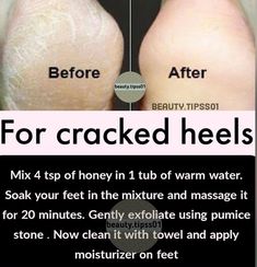 Legs At Home, Natural Skin Care Ingredients, Natural Face Skin Care, Basic Skin Care Routine, Skin Care Wrinkles, Beauty Tips For Glowing Skin