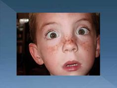 a young boy with freckles on his face