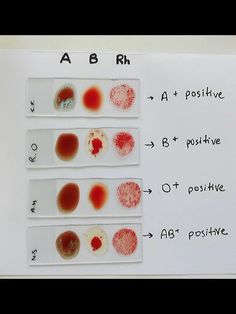 four different types of fingerprints are shown on a piece of paper with writing