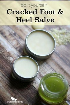 Salve Recipes, Herbal Salves, Healing Salves, Diy Lotion, Homemade Lotion, Diy Kosmetik, Homemade Bath Products, Homemade Beauty, Homemade Remedies