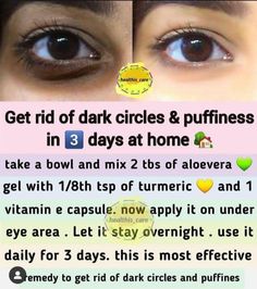 Homeremedy for dark circles At Home Skincare, Skin Home Remedies, Skin Care At Home, Skin Care Home Remedies, Natural Skin Care Ingredients, Clear Healthy Skin, Natural Skin Care Remedies, Eye Skin Care, Natural Face Skin Care