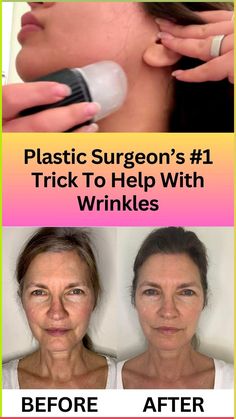 Top plastic surgeon has his wife do this every night. Facial Peels, Pro Makeup Tips, Eye Shape Makeup, Concealer Tricks, Double Chin Exercises, Blush Application, Sleep Essentials, Chin Exercises