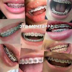 но это сложно и больно но красиво 😭 Orange Braces, Miraculous Ladybug Kiss