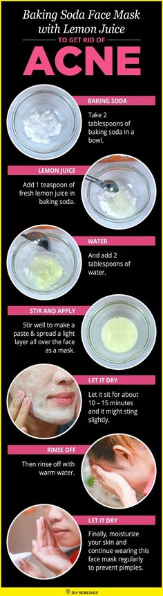 Face Masks For Acne, Masks For Acne, Baking Soda For Acne, Baking Soda Face Mask, Baking Soda Face, Homemade Facial Mask, Skin Face Mask, Acne Face Mask