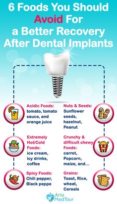 Dental Infographics, Dental Pictures, Dental Posts, Dental Posters