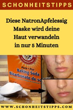 Diese Natron-Apfelessig-Maske wird deine Haut verwandeln in nur 5 Minuten Bali Body, Healthy Beauty, Beauty Make Up, Diy Beauty, Anti Aging, Fitness Motivation, Beauty Hacks, Massage, Make Up